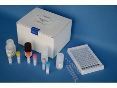 SCD21ELISA试剂盒人可溶性CD21试剂盒_生物试剂_实验室常用设备_供应_仪器交易网